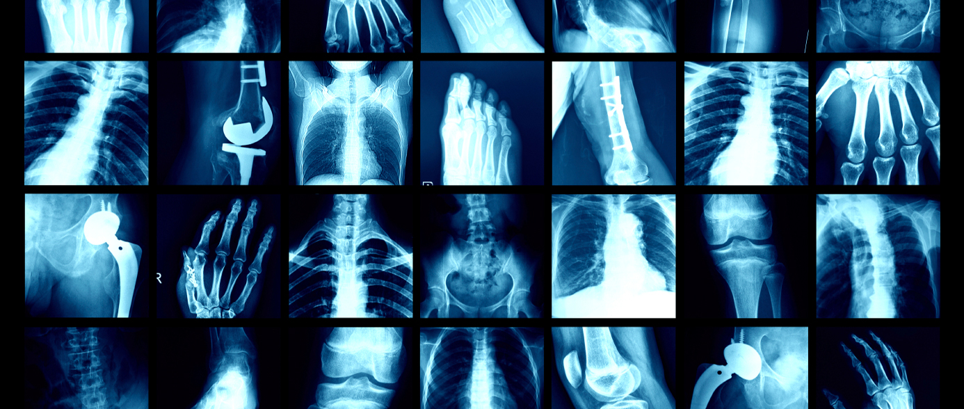 Sports injuries of all joints not just spine may be amendable to Chiropractic Care.  From the 